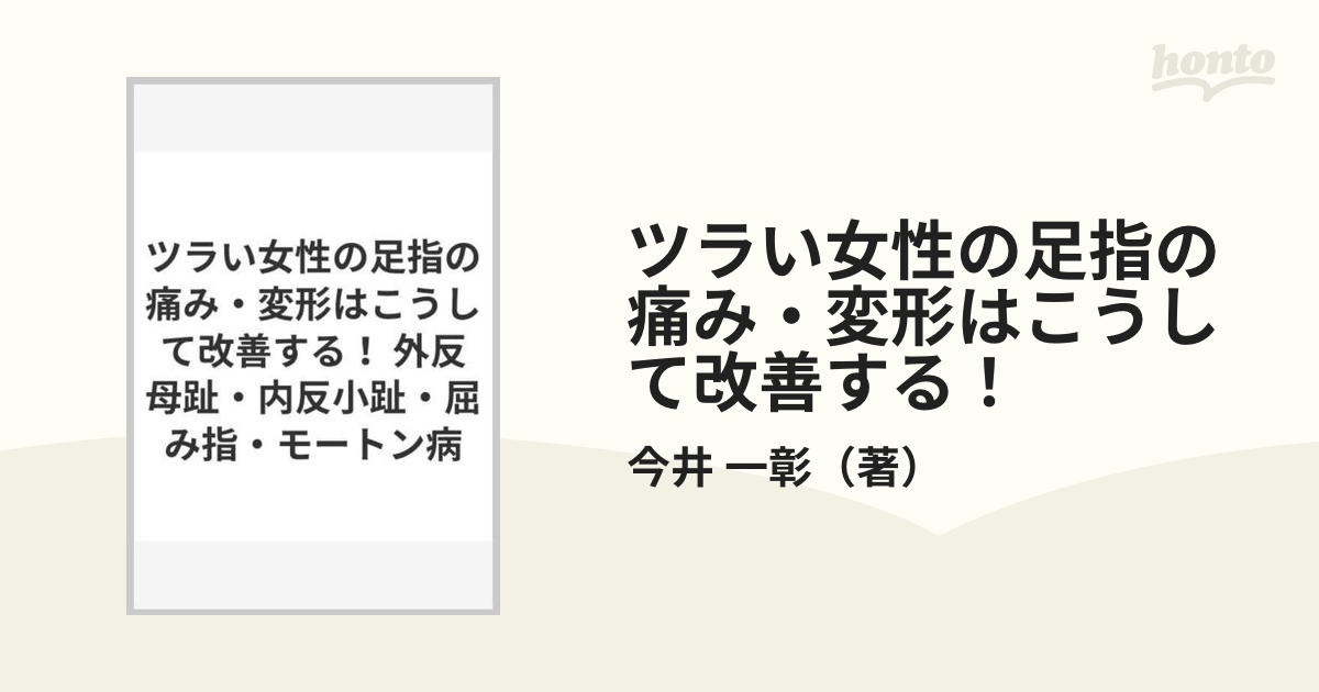 ツラい女性の足指の痛み・変形はこうして改善する！ 外反母趾・内反小趾・屈み指・モートン病