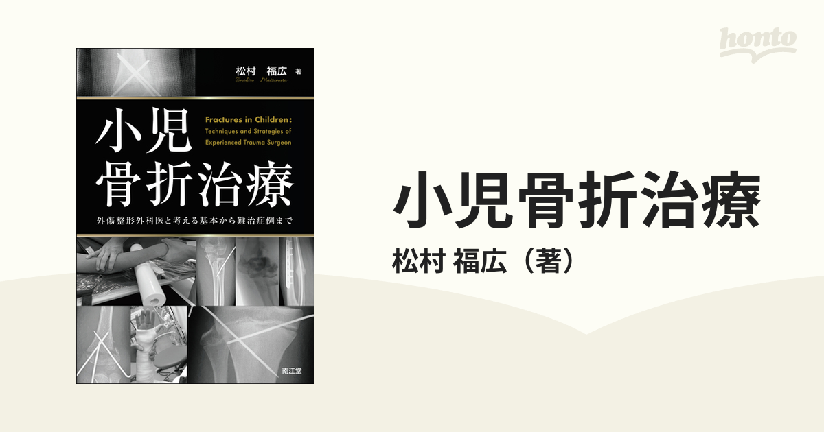 裁断済み】小児骨折治療 外傷整形外科と考える基本から難治症例まで 