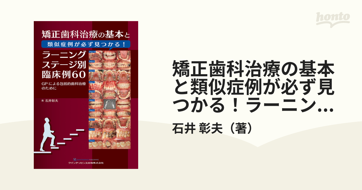 矯正歯科治療の基本と類似症例が必ず見つかるラーニングステージ別臨床