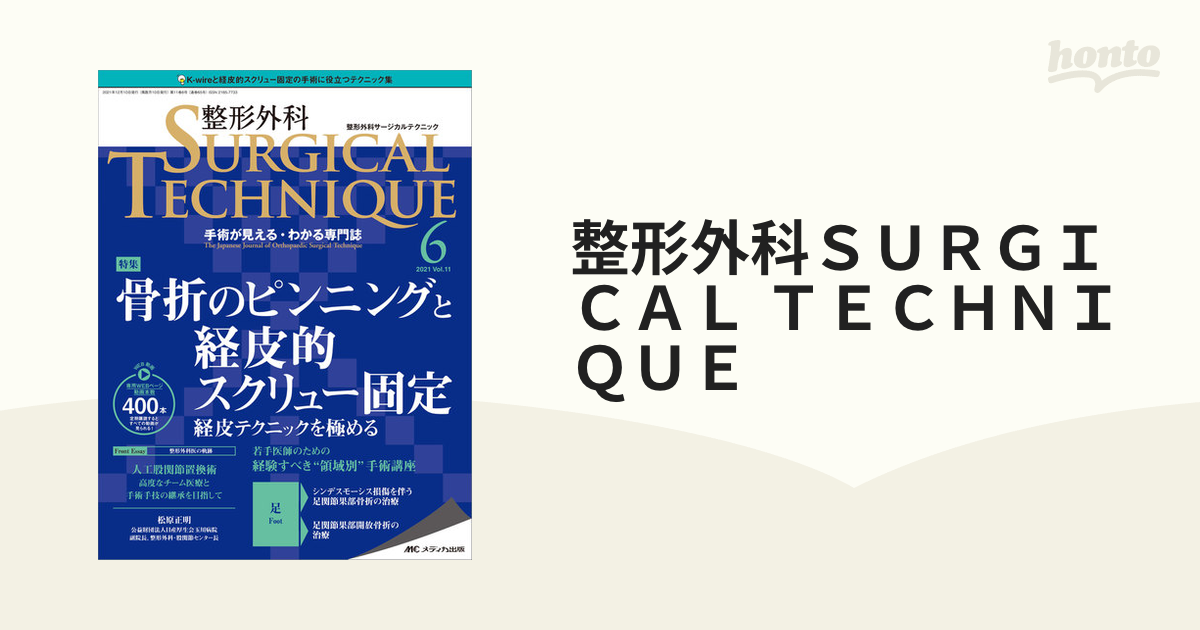 バードアイピンニングとは何ですか?