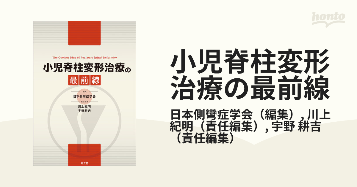側弯症治療の最前線 川上紀明