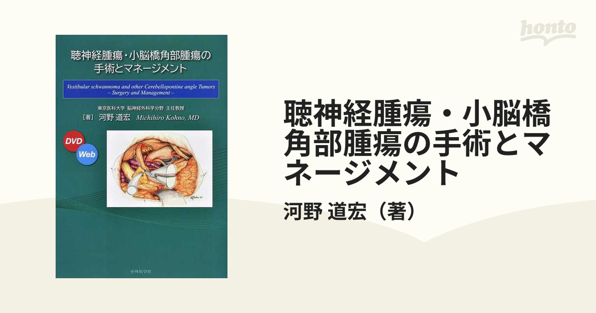 中外医学社398ページ聴神経腫瘍・小脳橋角部腫瘍の手術とマネージメント [新品]