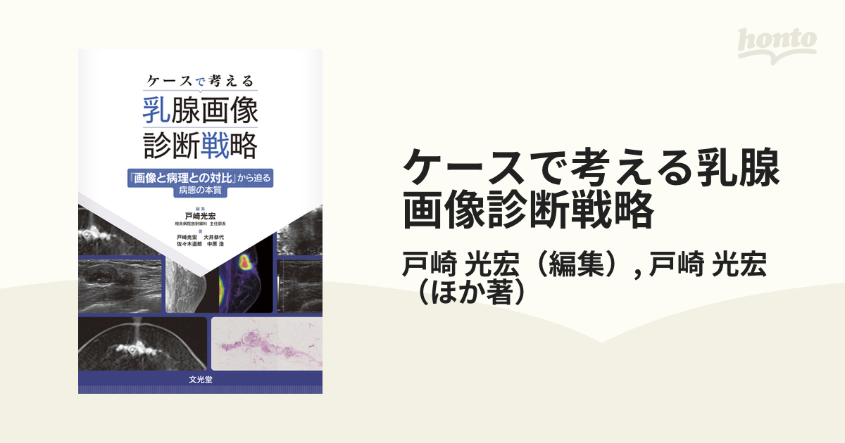 ケースで考える乳腺画像診断戦略 『画像と病理との対比』から迫る病態の本質