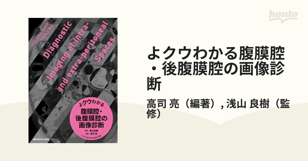 送料無料 よクウわかる腹膜腔・後腹膜腔の画像診断 よクウわかる腹膜腔 