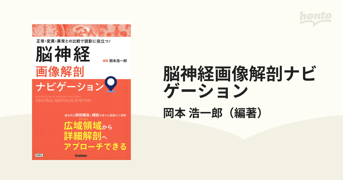 脳神経画像解剖ナビゲーション 正常・変異・異常との比較で読影に役立つ！