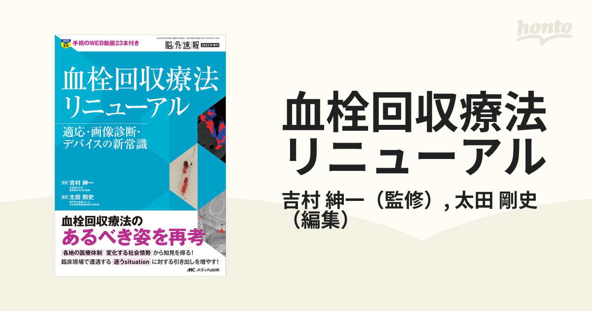 ファッション-血栓回収療法Ｔｅｃｈｎｉｃａｌ Ｔｉｐｓ テクニックを