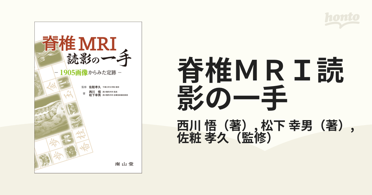 脊椎MRI読影の一手 - 通販 - meubemkerer.com.br