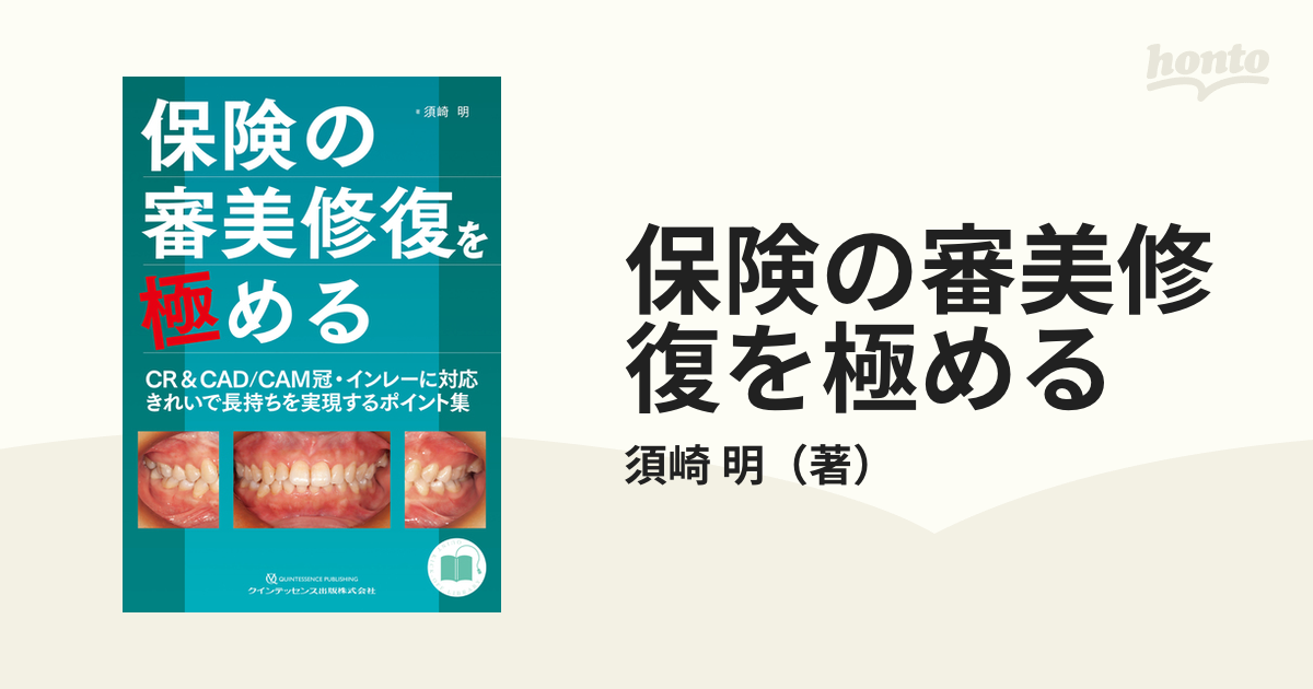 保険の審美修復を極める ＣＲ＆ＣＡＤ／ＣＡＭ冠・インレーに対応