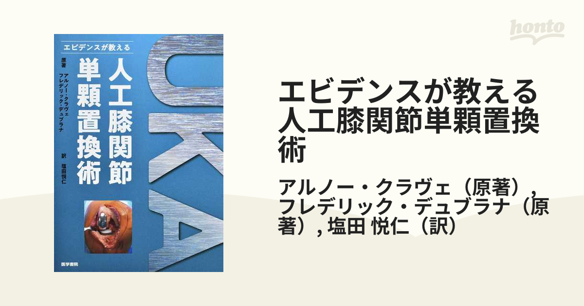 エビデンスが教える人工膝関節単顆置換術