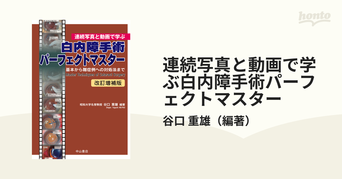 裁断済み】連続写真と動画で学ぶ 白内障手術パーフェクトマスター-