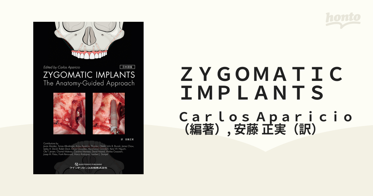 ＩＭＰＬＡＮＴＳ　ＺＹＧＯＭＡＴＩＣ　日本語版　正実　Ｔｈｅ　Ａｎａｔｏｍｙ‐Ｇｕｉｄｅｄ　Ａｐａｒｉｃｉｏ/安藤　Ａｐｐｒｏａｃｈの通販/Ｃａｒｌｏｓ　紙の本：honto本の通販ストア