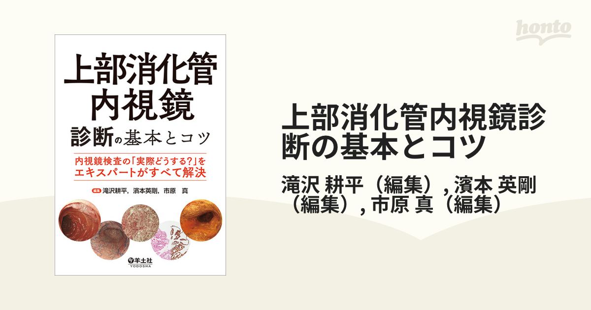 上部消化管内視鏡診断の基本とコツ 内視鏡検査の「実際どうする？」をエキスパートがすべて解決