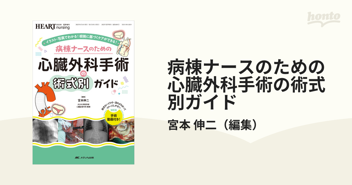 病棟ナースのための心臓外科手術の術式別ガイド : イラスト