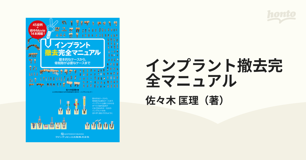 インプラント撤去完全マニュアル 基本的なケースから，骨削除が必要な