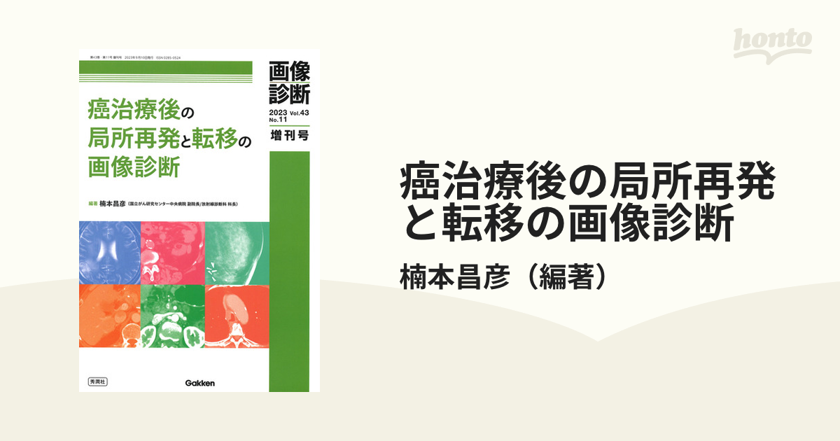 癌治療後の局所再発と転移の画像診断の通販/楠本昌彦 - 紙の本：honto本の通販ストア