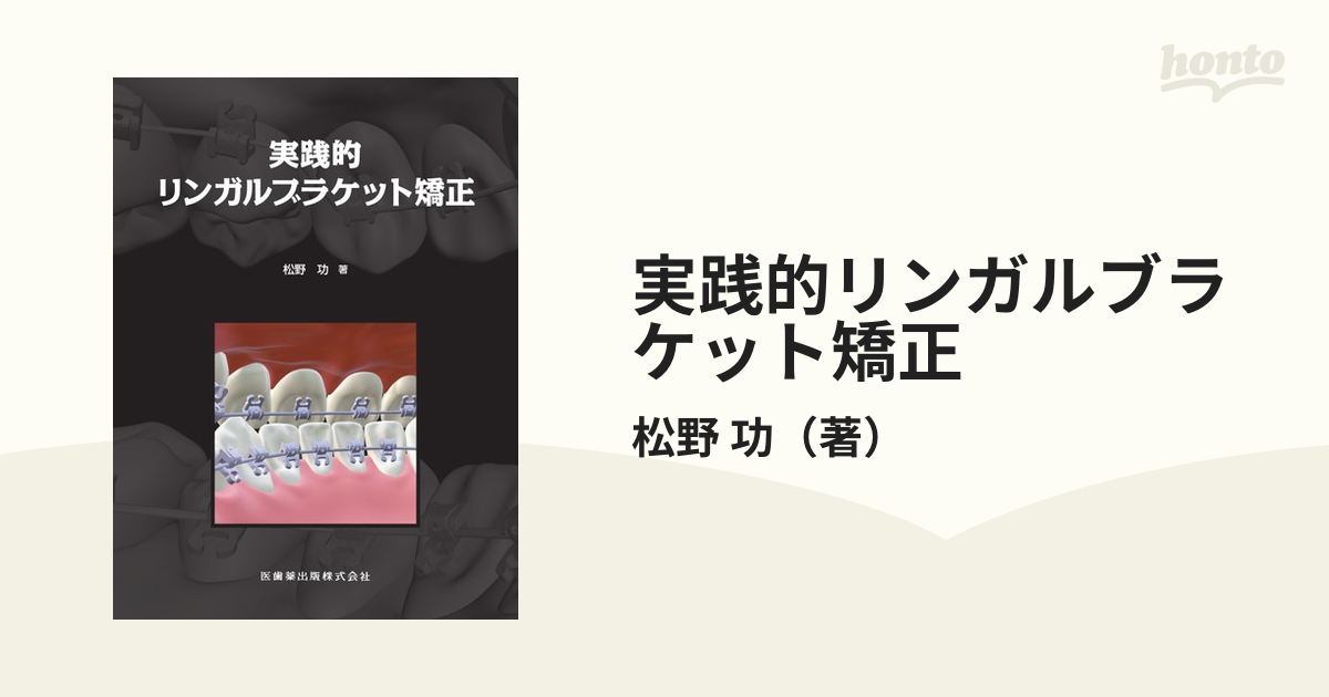 実践的リンガルブラケット矯正の通販/松野 功 - 紙の本：honto本の通販 ...