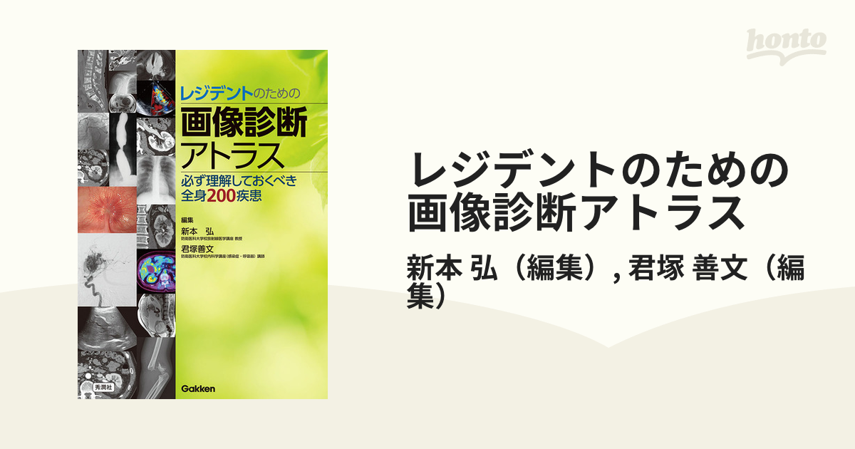 レジデントのための画像診断アトラス 必ず理解しておくべき全身２００疾患