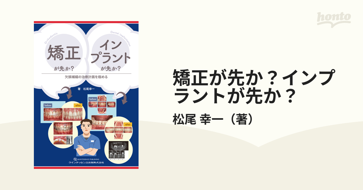 矯正が先か? インプラントが先か? : 欠損補綴の治療計画を極める-