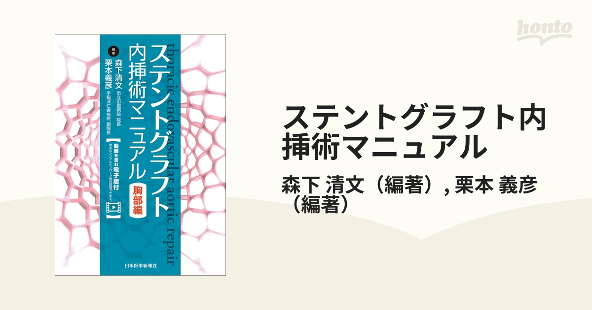 ステントグラフト内挿術マニュアル 胸部編