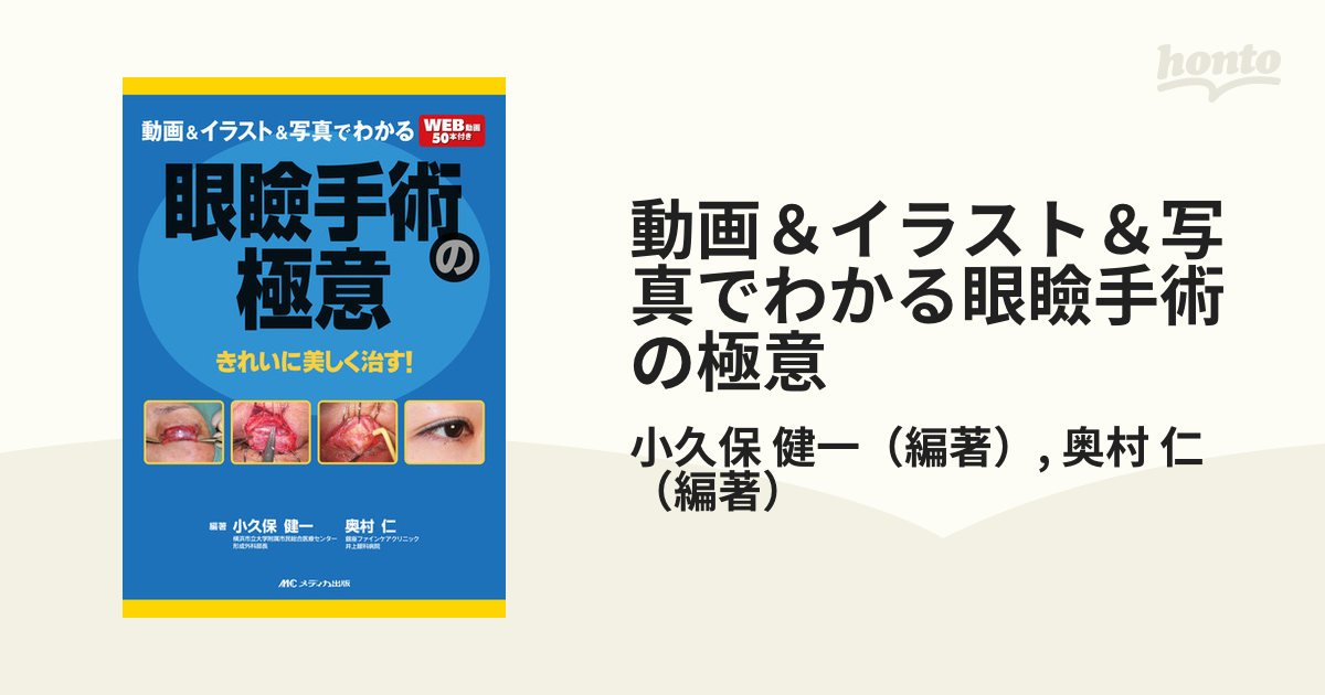 【裁断済み】動画＆イラストでわかる 眼瞼手術の極意 : きれいに美しく治す! 動画＆イラスト＆写真でわかる眼瞼手術の極意: きれいに美しく