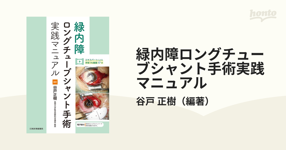 緑内障ロングチューブシャント手術実践マニュアル