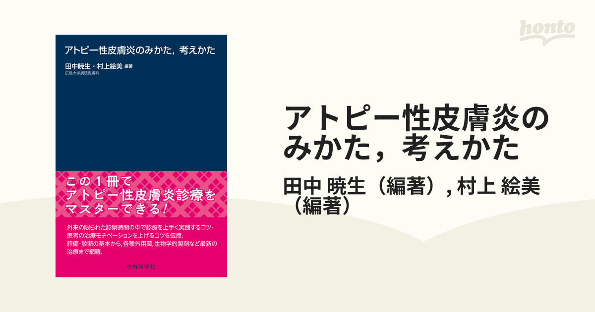 アトピー性皮膚炎のみかた，考えかた