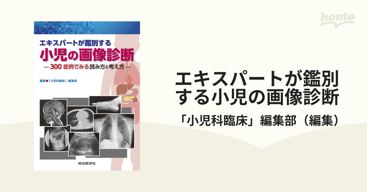 画像所見のよみ方と鑑別診断 第2版 胆・膵 花田敬士 - 医学・薬学