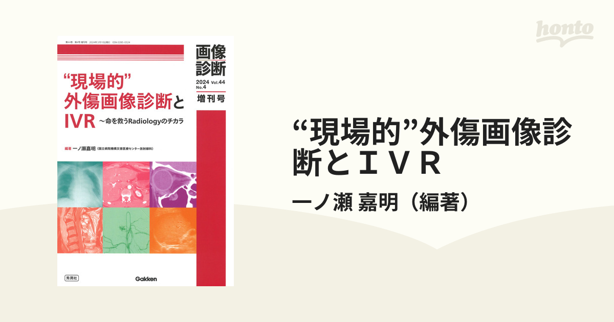 “現場的”外傷画像診断とＩＶＲ 命を救うＲａｄｉｏｌｏｇｙのチカラ