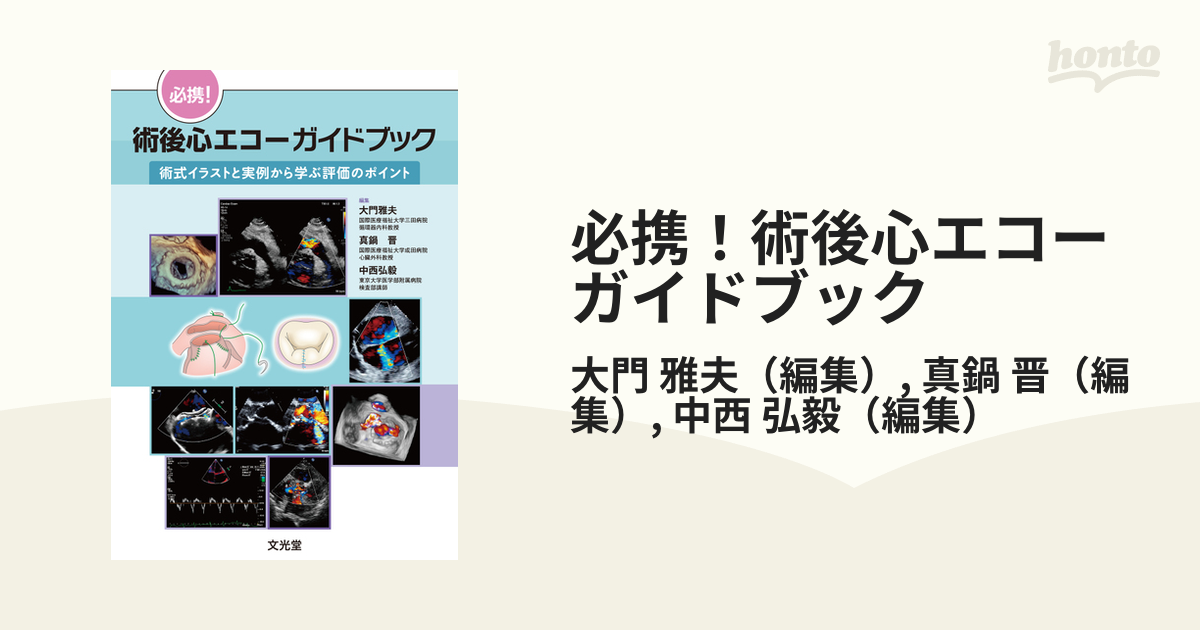 必携！術後心エコーガイドブック 術式イラストと実例から学ぶ評価のポイント