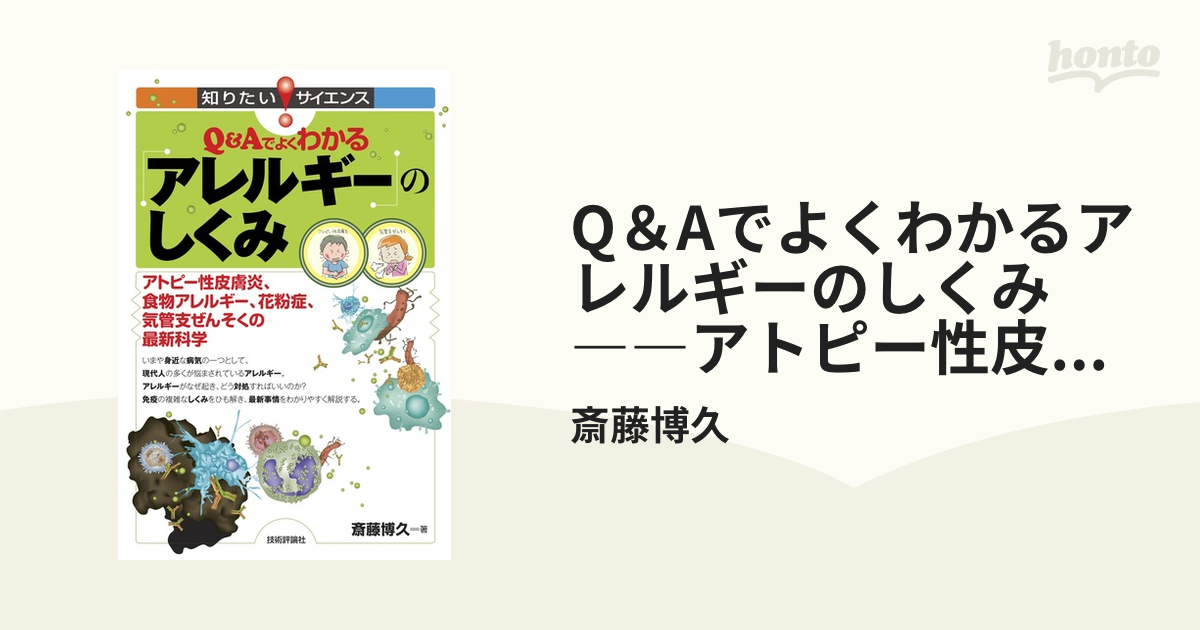 Q＆Aでよくわかるアレルギーのしくみ ――アトピー性皮膚炎、食物