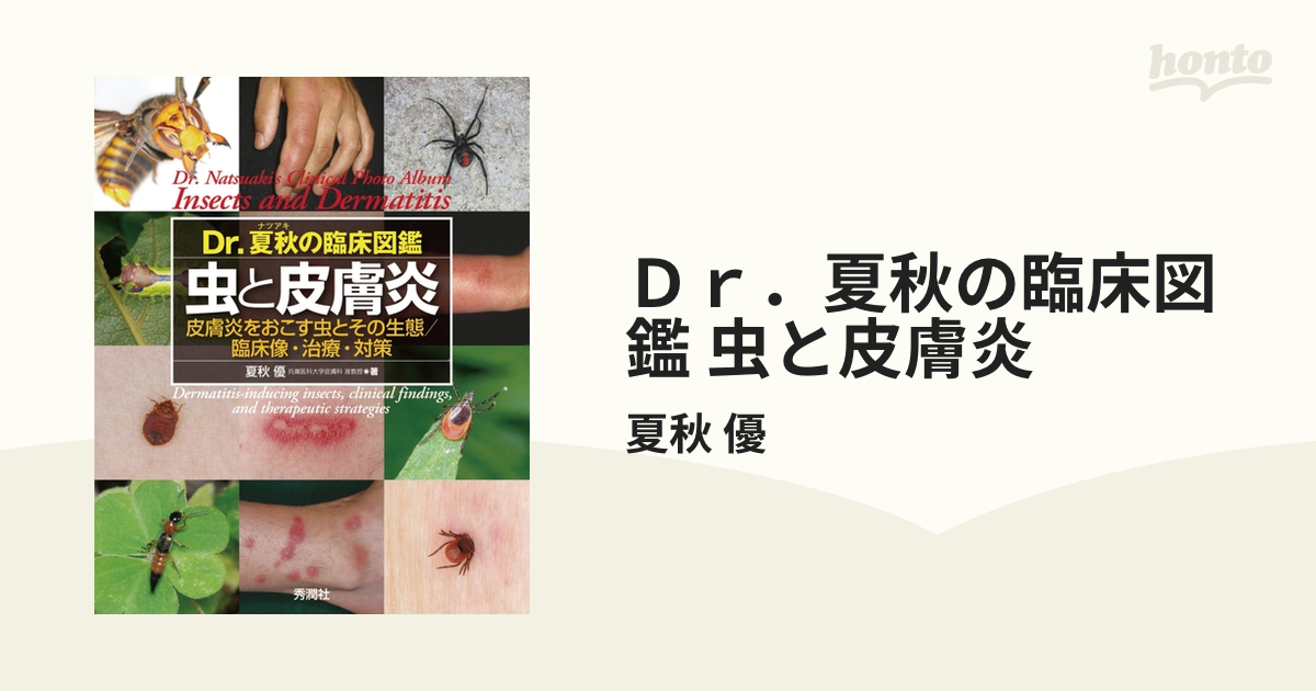 格安ショッピング Dr.夏秋の臨床図鑑 虫と皮膚炎 - 本
