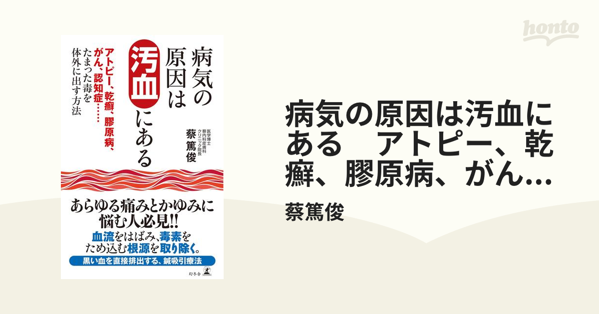 病気の原因は汚血にある アトピー、乾癬、膠原病、がん、認知症